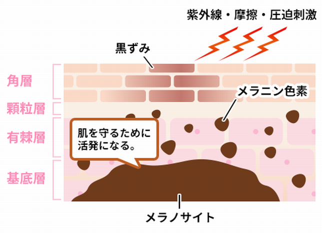 性器 黒ずみ